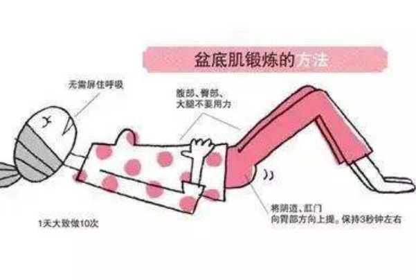 凯格尔运动害了多少人:导致分娩困难(用错方法起副作用)