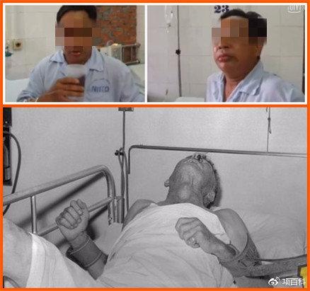 黄子韬被狗咬打疫苗!3类狂犬病高发群体中,都有谁?