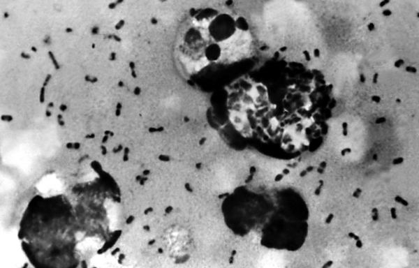 乌死病是怎样中断的?欧洲乌死病十大隐蔽究竟