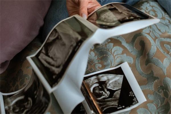 备孕生男孩秘诀是什么.jpg 备孕生男孩秘诀是什么.jpg