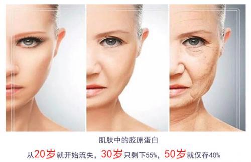 胶原蛋白肽十大排名